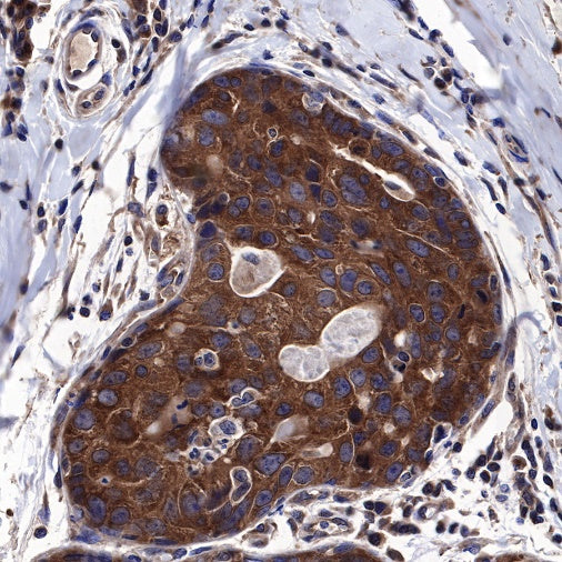 Atg5 Recombinant Rabbit mAb (SDT-456-9)
