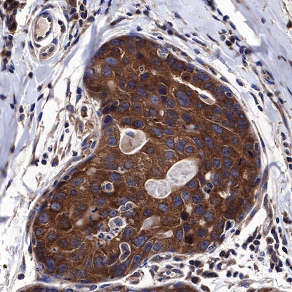 Atg5 Recombinant Rabbit mAb (SDT-456-9)