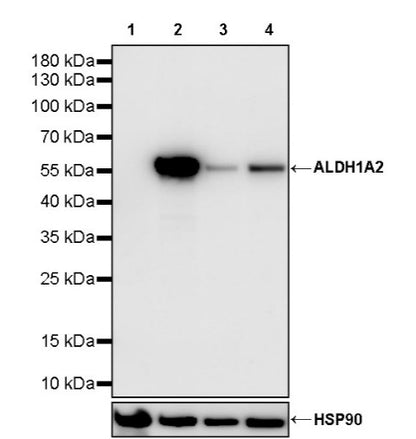 ALDH1A2 Recombinant Rabbit mAb (S-3569-78)