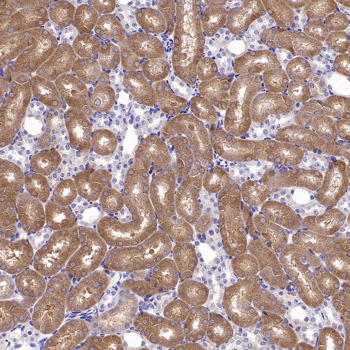 Phospho-eIF4E (Ser209) Recombinant Rabbit mAb (S-2652-195)