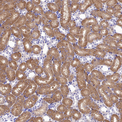Phospho-eIF4E (Ser209) Recombinant Rabbit mAb (S-2652-195)