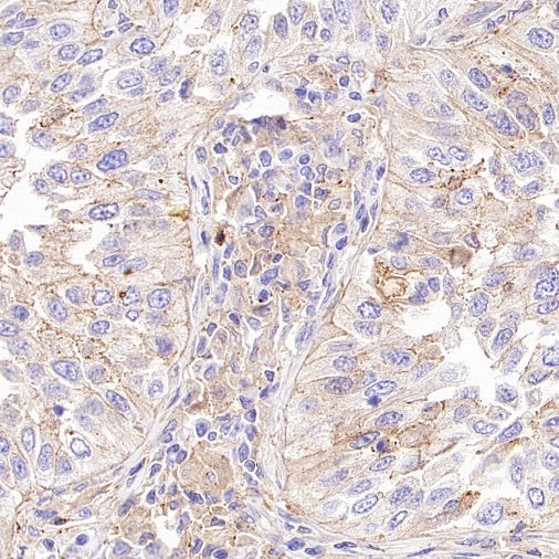 B7-H2/ICOSLG Recombinant Rabbit mAb (S-3306-12)