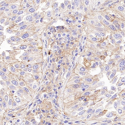 B7-H2/ICOSLG Recombinant Rabbit mAb (S-3306-12)