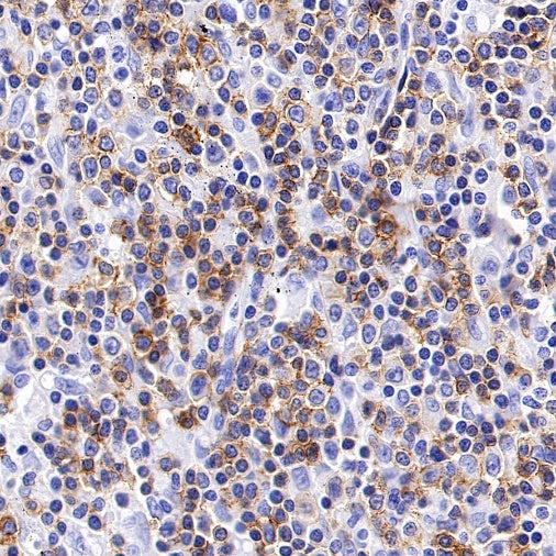CD6 Recombinant Rabbit mAb (S-1512-39)