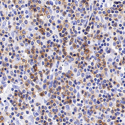 CD6 Recombinant Rabbit mAb (S-1512-39)
