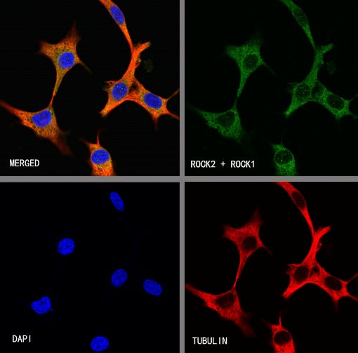 ROCK1+ROCK2 Recombinant Rabbit mAb (S-1305-26)