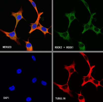 ROCK1+ROCK2 Recombinant Rabbit mAb (S-1305-26)