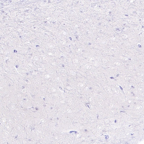 Neutrophil Elastase (ELA2) Recombinant Rabbit mAb (S-3766-3)