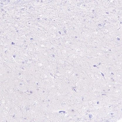 Neutrophil Elastase (ELA2) Recombinant Rabbit mAb (S-3766-3)