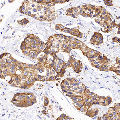Rab3D Recombinant Rabbit mAb (S-4406-22)