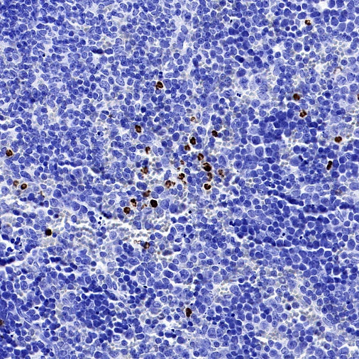 PAD4 Recombinant Rabbit mAb (SDT-2416-3)