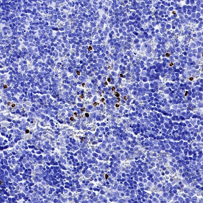 PAD4 Recombinant Rabbit mAb (SDT-2416-3)