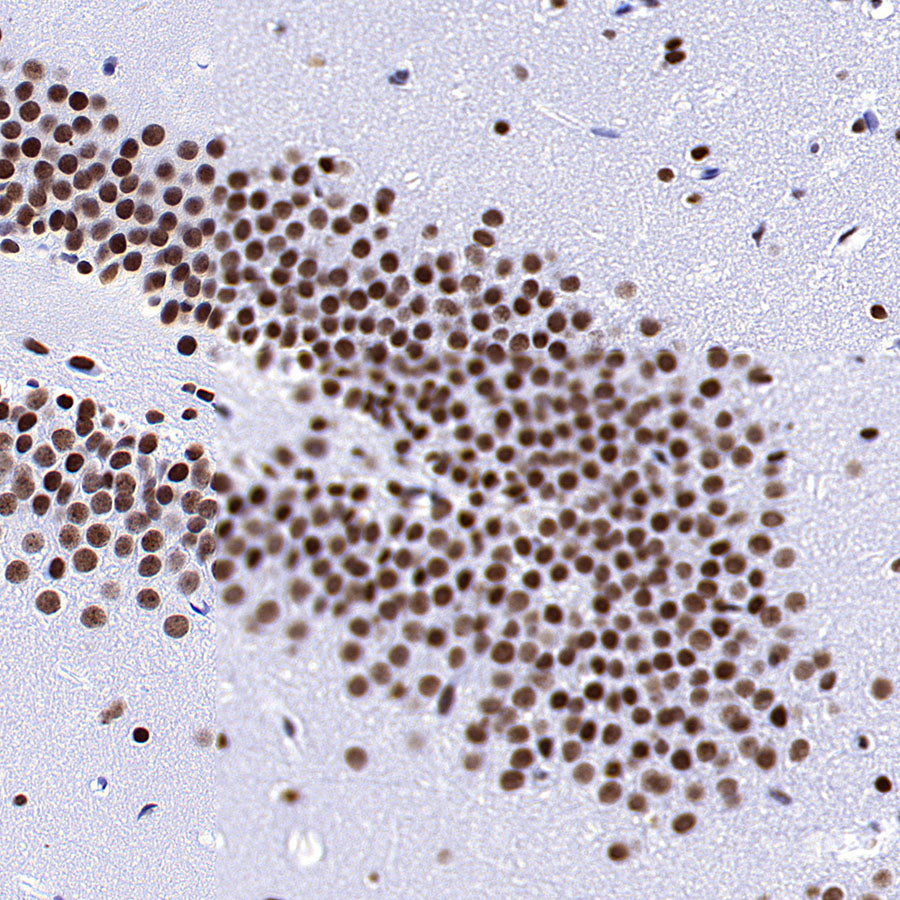 RBBP4 Rabbit Polyclonal Antibody