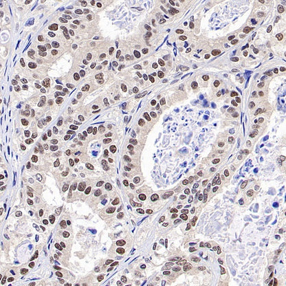 MLH1 Recombinant Mouse mAb (SDT-R702)
