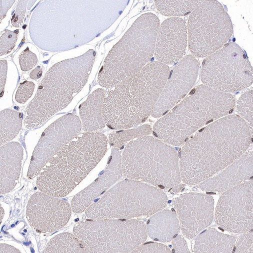 MEK3 Recombinant Rabbit mAb (S-835-23)