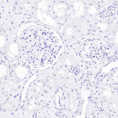 MYH7 Recombinant Rabbit mAb ,PBS Only (SDT-2936-44)