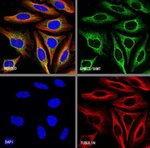 SHMT2/SHMT Recombinant Rabbit mAb (S-1581-5)