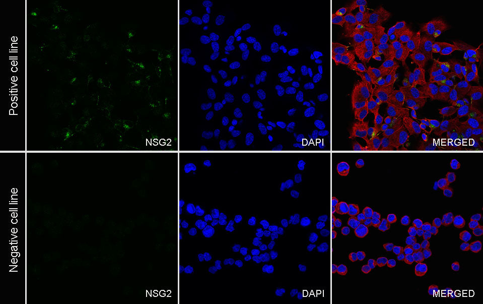 NSG2 Recombinant Rabbit mAb (S-3789-136)