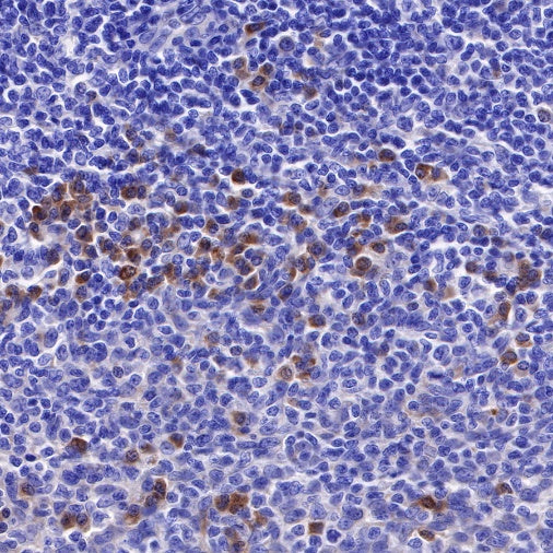 Bcl-xL Recombinant Rabbit mAb (S-487-28)