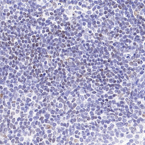 Histone H3 (tri methyl K27) Recombinant Rabbit mAb (S-4098)