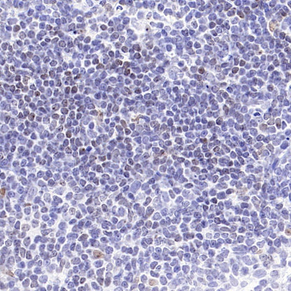 Histone H3 (tri methyl K27) Recombinant Rabbit mAb (S-4098)