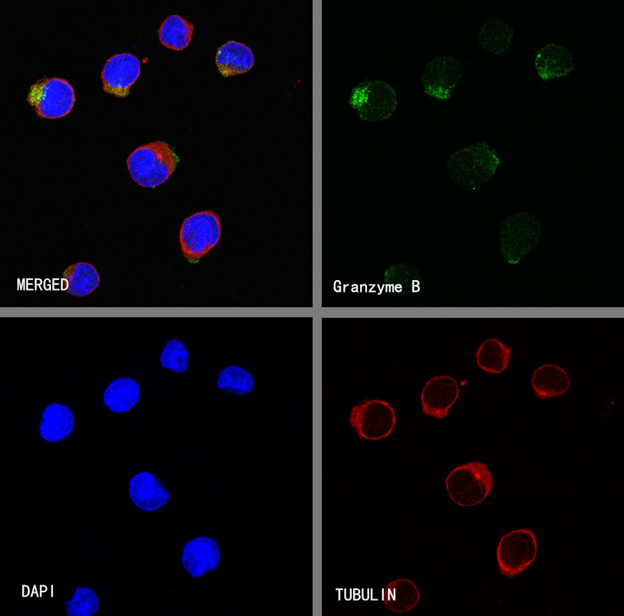 Granzyme B Recombinant Rabbit mAb (S-357-54)