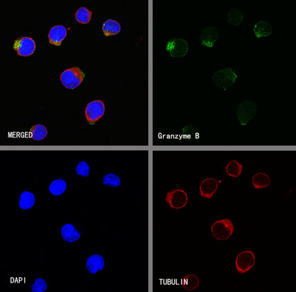 Granzyme B Recombinant Rabbit mAb (S-357-54)