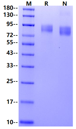 GPNMB His Tag Protein, Human