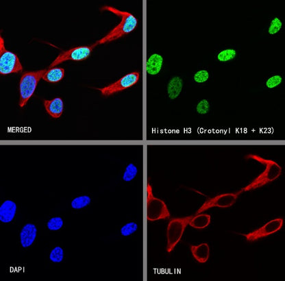Histone H3 (Crotonyl K18 + K23) Recombinant Rabbit mAb (S-R410)