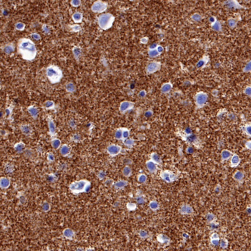 Vesicular Glutamate Transporter 1 (VGLUT1) Recombinant Rabbit mAb (S-1118-58)