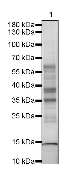 Acetyllysine Recombinant Rabbit mAb (SDT-R096)
