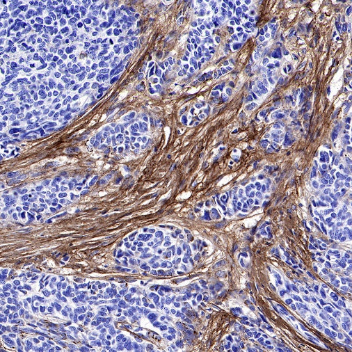 S-RMab® Collagen I (COL1A1) Recombinant Rabbit mAb (S-463-3)