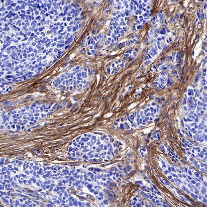 S-RMab® Collagen I (COL1A1) Recombinant Rabbit mAb (S-463-3)