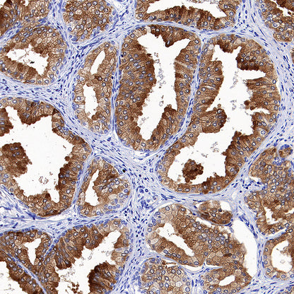 TIMP1 Recombinant Rabbit mAb (S-5147)