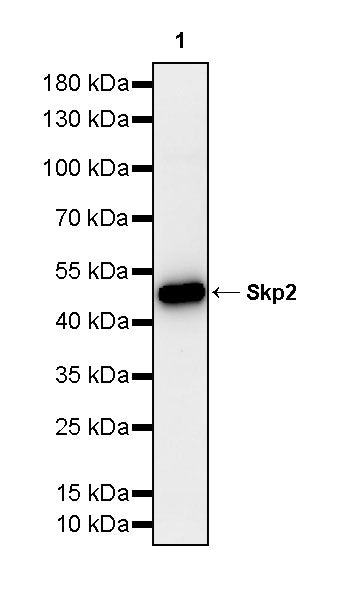 Skp2 Recombinant Rabbit mAb (S-4906)