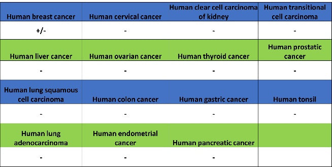 Rab11 Recombinant Rabbit mAb (S-1601-68)