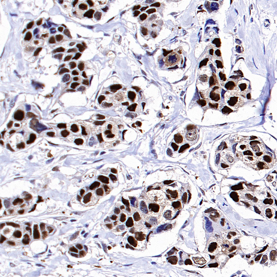 PCNA Recombinant Rabbit mAb (S-5313)