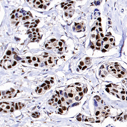 PCNA Recombinant Rabbit mAb (S-5313)