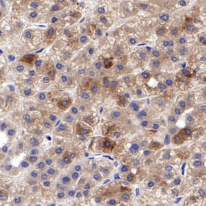 CHI3L1 Recombinant Rabbit mAb (S-324-38)