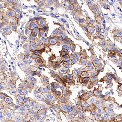 TACSTD2/TROP2 Recombinant Rabbit mAb (S-R238)