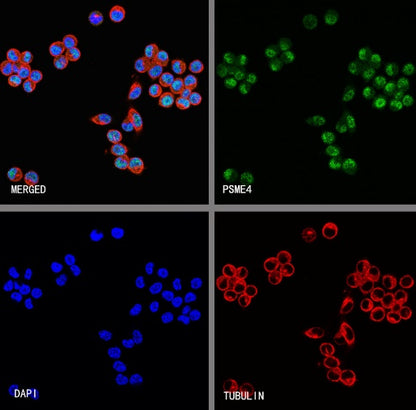 PSME4 Recombinant Rabbit mAb (S-3132-44)