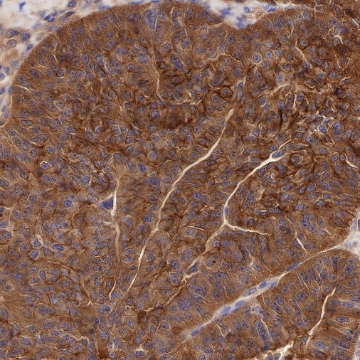 Mesothelin Recombinant Rabbit mAb (SDT-347-15)