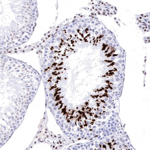 Propionyl-Histone H4 (Lys5) Recombinant Rabbit mAb (S-R093)