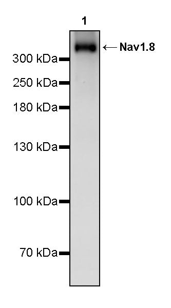 Nav1.8 Recombinant Rabbit mAb (S-3631-104)