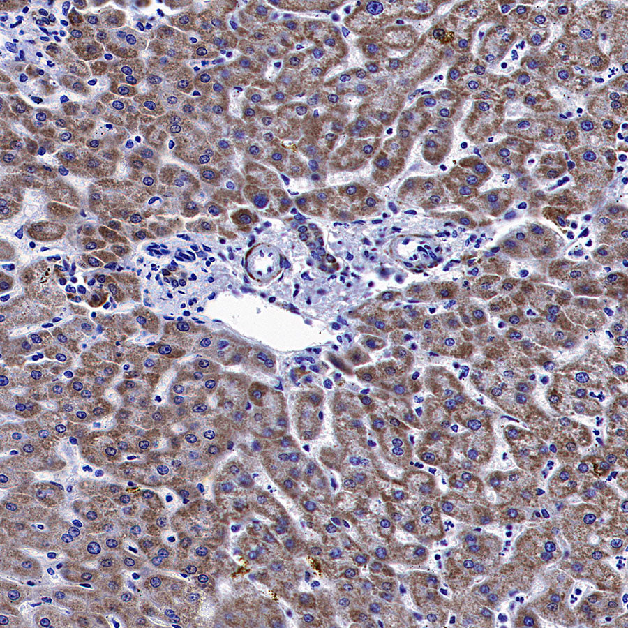 Monoamine Oxidase B/MAOB Recombinant Rabbit mAb (S-5317)