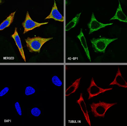 4E-BP1 Recombinant Rabbit mAb (S-1654-47)