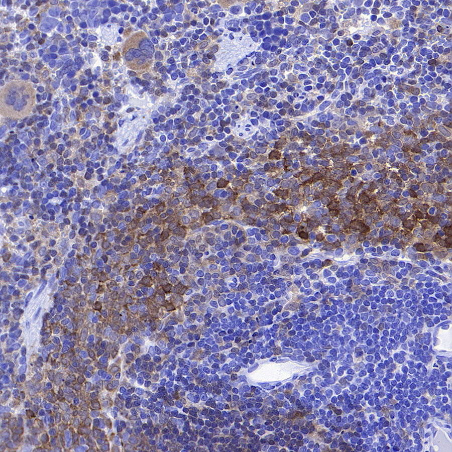 Syk Recombinant Rabbit mAb (S-4400-11)