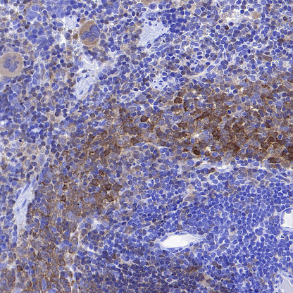 Syk Recombinant Rabbit mAb (S-4400-11)
