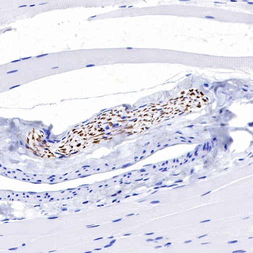 Neurofilament L Recombinant Rabbit mAb (S-635-214)