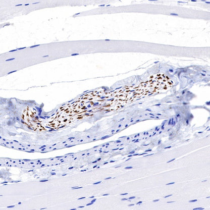 Neurofilament L Recombinant Rabbit mAb (S-635-214)